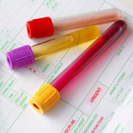 STD Blood tests